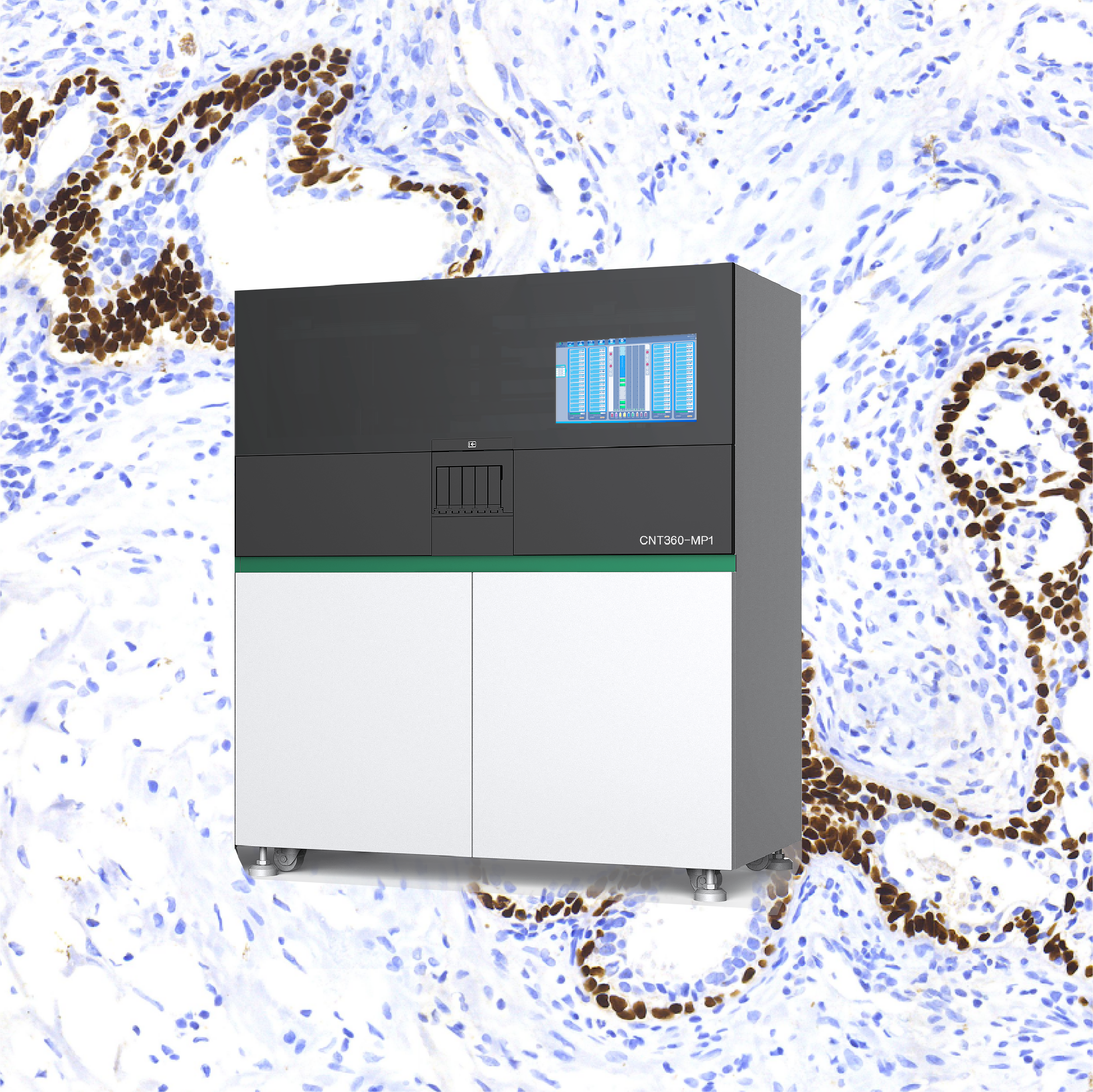 IMMUNOHISTOCHEMISTRY