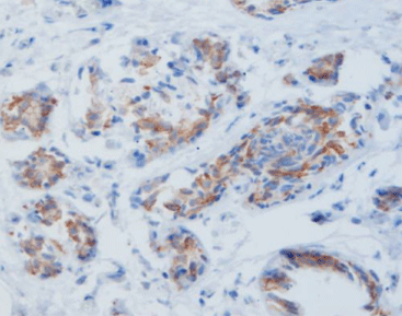 [Instrument] MicroStacker™ Flex Polymer Detection Kit