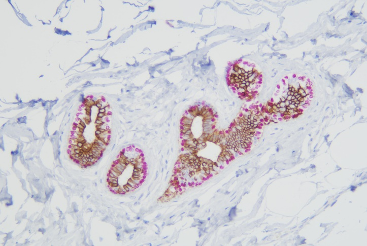 CK5/6/p63 detection reagent (Immunohistochemical)