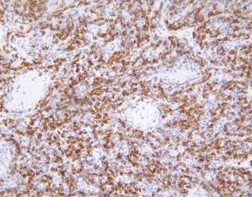 Understanding the Role of Primary Antibody in Immune Response