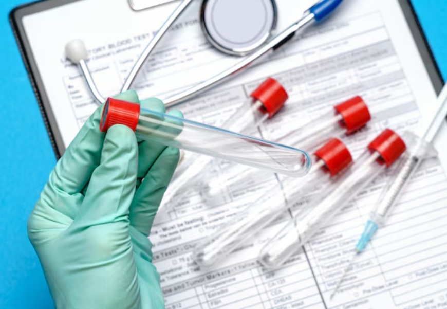 Unveiling the Top Common IHC Markers in Medical Research