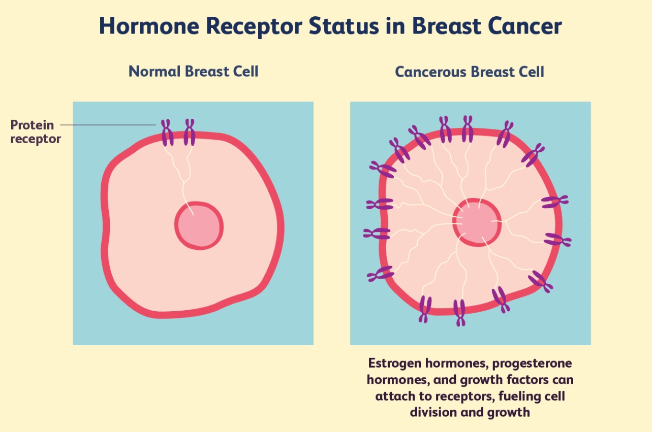 A Guide to Hormone Receptor Status What Happens If ER Is Positive