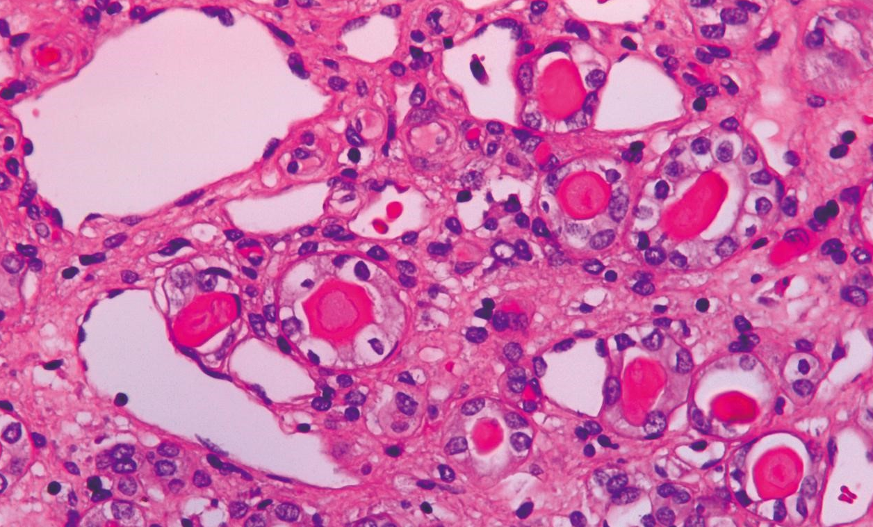 Hematoxylin Staining Solution