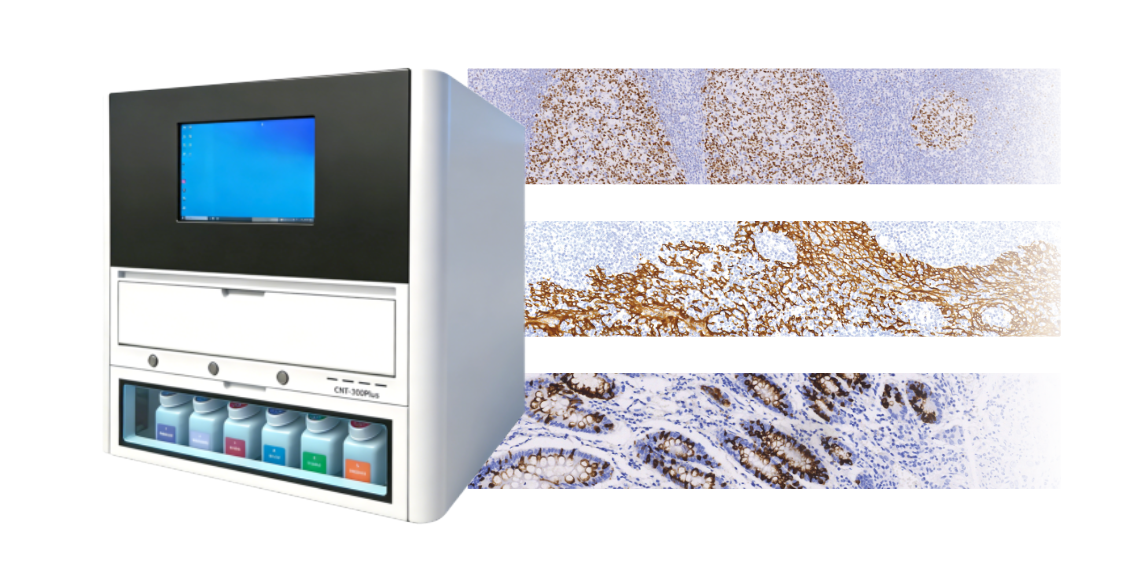 Celnovte Fully Automated Immunohistochemistry Complete Solution