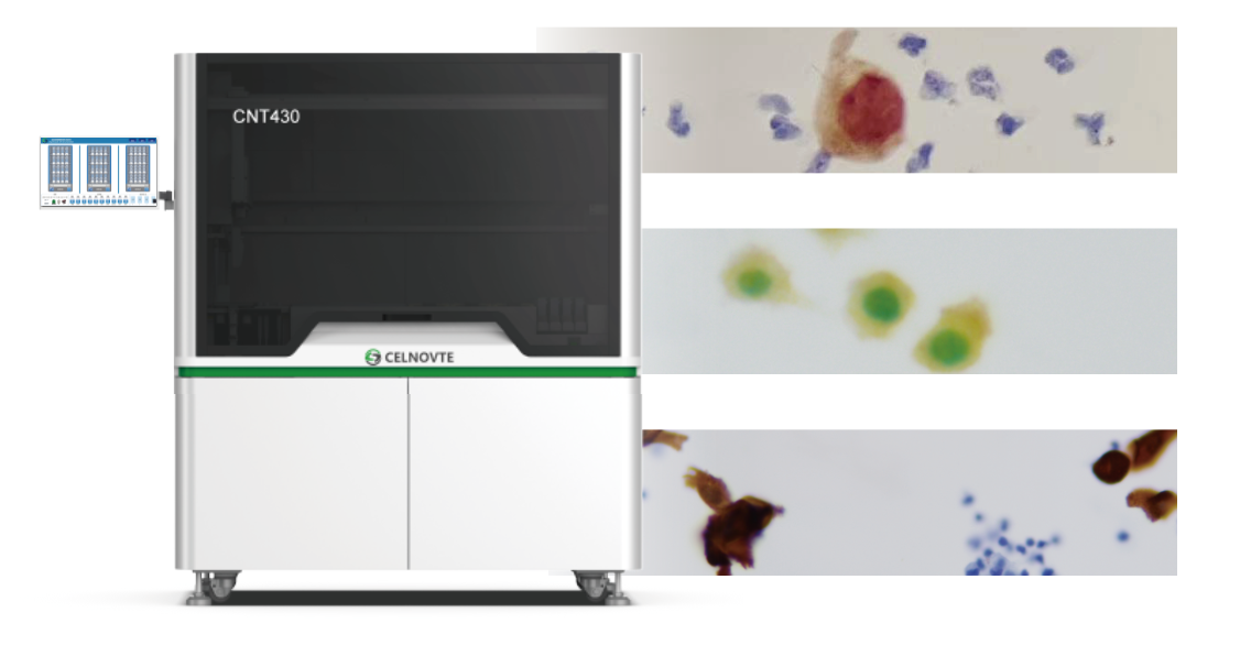 Celnovte Fully Automated Immunocytochemistry Solution